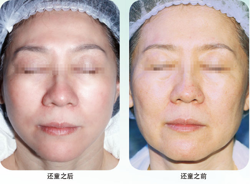 bte·365(中国)体育在线官网