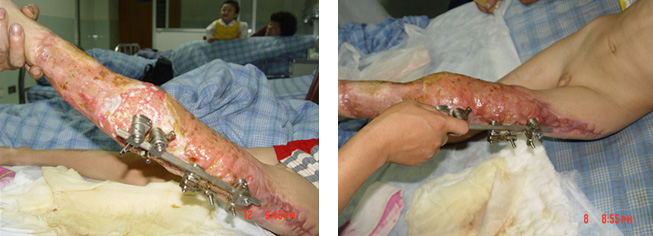 bte·365(中国)体育在线官网