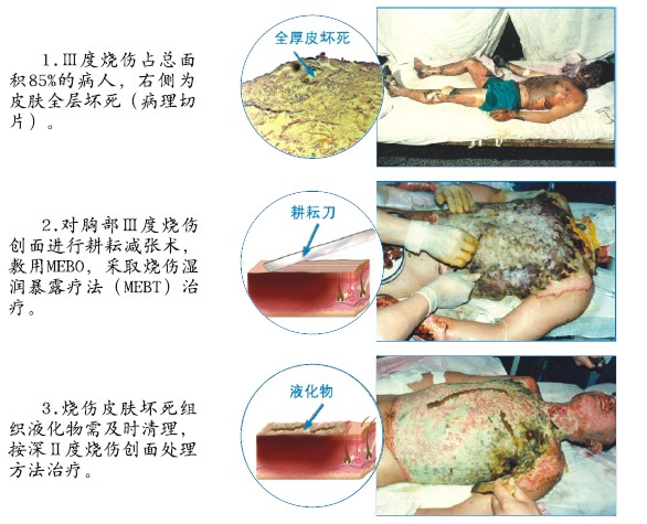 bte·365(中国)体育在线官网