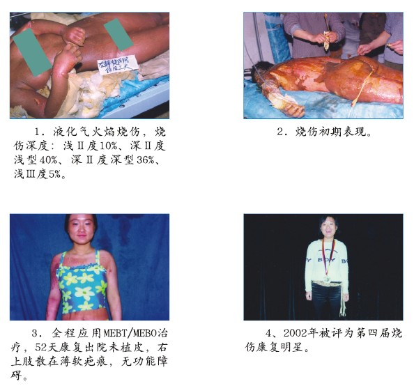 bte·365(中国)体育在线官网