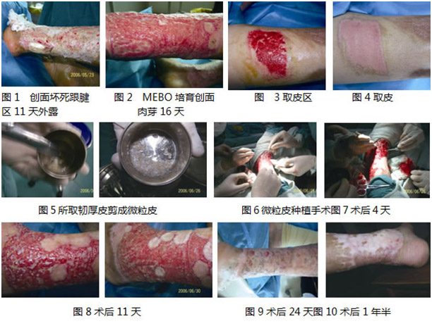bte·365(中国)体育在线官网